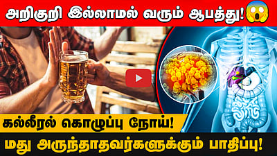 இளைஞர்களை அதிகம் பாதிக்கும் கல்லீரல் கொழுப்பு நோய்!! காரணமும் தீர்வும்! | Fatty Liver | Health Tips