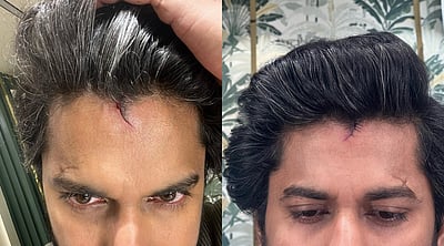 படப்பிடிப்பில் காயம், அடுத்த காட்சிக்கு உடனே தயாரான நானி! இயக்குநர் நெகிழ்ச்சி!