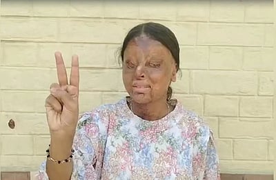 அமில வீச்சில் பார்வையிழந்த மாணவி... பிளஸ் 2 தேர்வில் 95.6% எடுத்து சாதனை! 