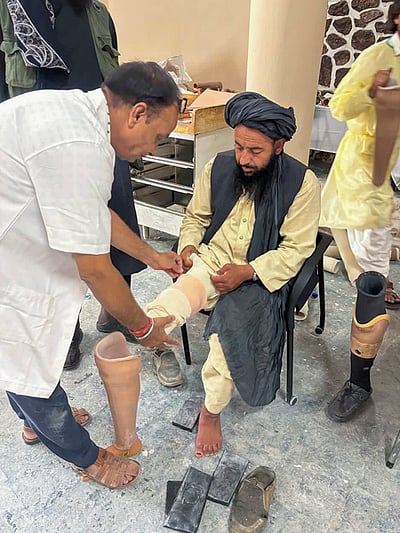 ஆப்கானிஸ்தானில் 75 பேருக்கு செயற்கை கால்கள்: இந்தியா மனிதாபிமான உதவி