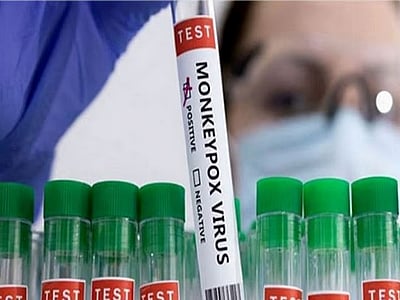 ஜூலையில் மட்டும்.. 47 நாடுகளில் 4,000 குரங்கு அம்மை பாதிப்புகள்!