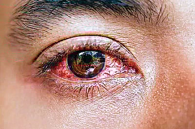 ஆயுள் காக்கும் ஆயுர்வேதம்: கண்நோய் நீங்க...