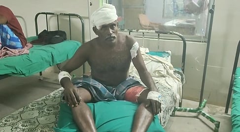 காட்டுப் பன்றி கடித்ததில் விவசாயி காயம்