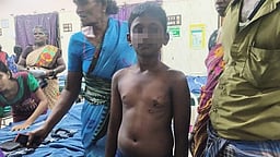 வி.கே.புரத்தில் தெரு நாய் கடித்து 10-க்கும் மேற்பட்டோா் காயம்