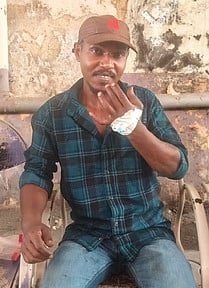 காரையாறு காணிக்குடியிருப்பில் 
சிறுத்தை தாக்கி இளைஞா் காயம்