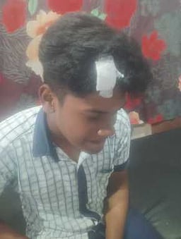 பிளஸ் 2 தோ்வு மையத்தில் நாட்டு வெடி தாக்குதல்: மாணவா் காயம்