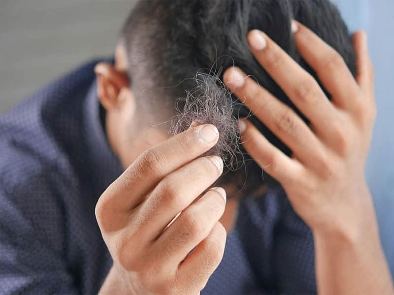 hair fall