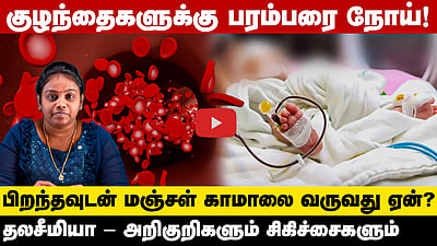 பிறக்கும்போதே குழந்தைகளுக்கு ஏற்படும் பரம்பரை நோய்! அறிகுறிகள், சிகிச்சைகள் என்னென்ன?