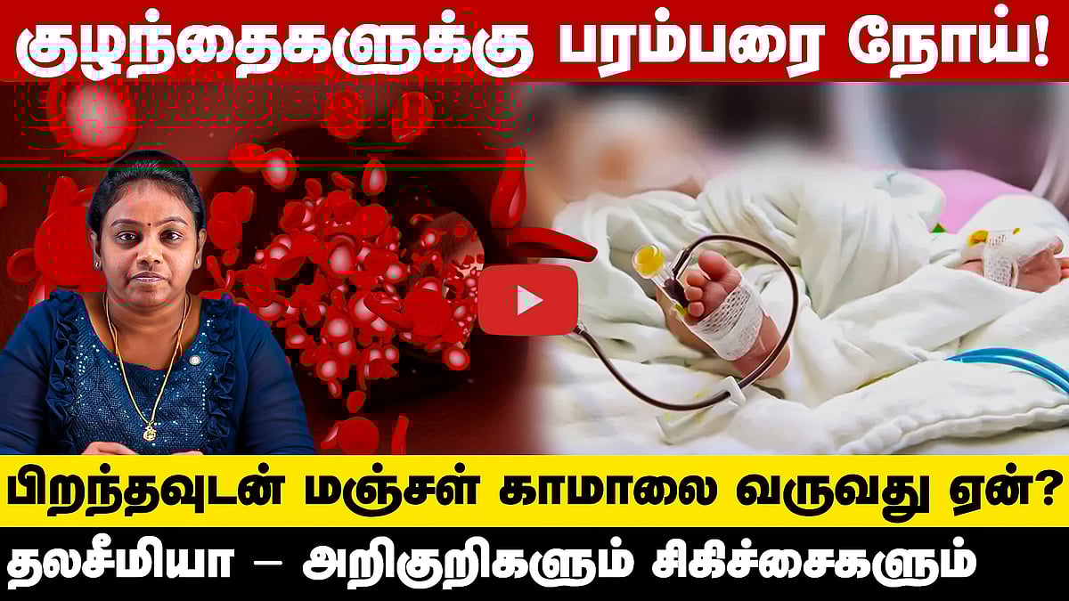 பிறக்கும்போதே குழந்தைகளுக்கு ஏற்படும் பரம்பரை நோய்! அறிகுறிகள், சிகிச்சைகள் என்னென்ன?