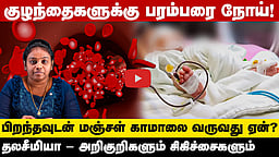பிறக்கும்போதே குழந்தைகளுக்கு ஏற்படும் பரம்பரை நோய்! அறிகுறிகள், சிகிச்சைகள் என்னென்ன?