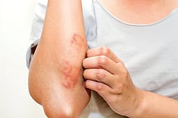 ஆயுள் காக்கும் ஆயுர்வேதம்: கடுமையான அரிப்பைக் குணப்படுத்த...