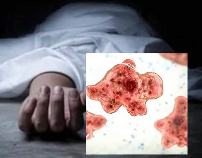 Woman dies of suspected amoebic meningoencephalitis in Kerala