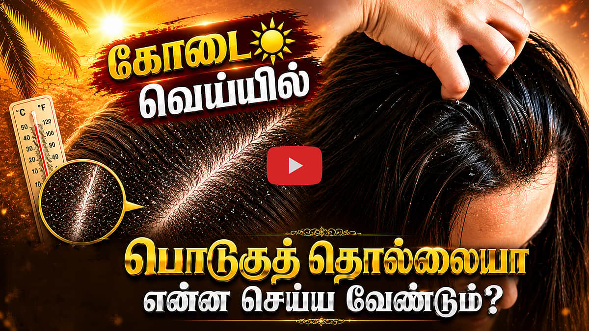 கோடையில் பொடுகுத் தொல்லை அதிகம் ஏற்படுவது ஏன்? | Life Style | Hair Health | Dandruff