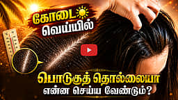கோடையில் பொடுகுத் தொல்லை அதிகம் ஏற்படுவது ஏன்? | Life Style | Hair Health | Dandruff