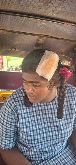 பள்ளி மேற்கூரை சிமென்ட் பூச்சு
விழுந்ததில் மாணவி காயம்