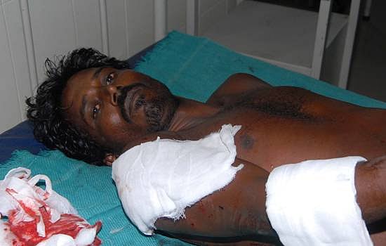 நிலப்பிரச்னையில் தகராறு: அண்ணன் சுட்டு தம்பி படுகாயம்