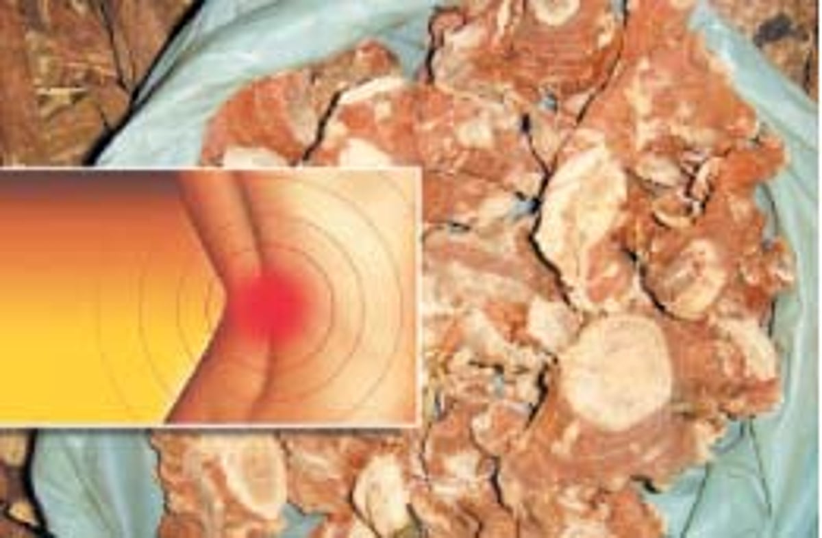 ஆயுள் காக்கும் ஆயுர்வேதம்: இடுப்பில் கடுமையான வலி...