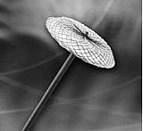 தமிழகத்தில் அரசு மருத்துவமனையில் முதல்முறை அறுவைச் சிகிச்சை இன்றி இதய ஓட்டை அடைப்பு