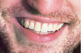 ஆயுள் காக்கும் ஆயுர்வேதம்: பற்களைப் பலப்படுத்த..