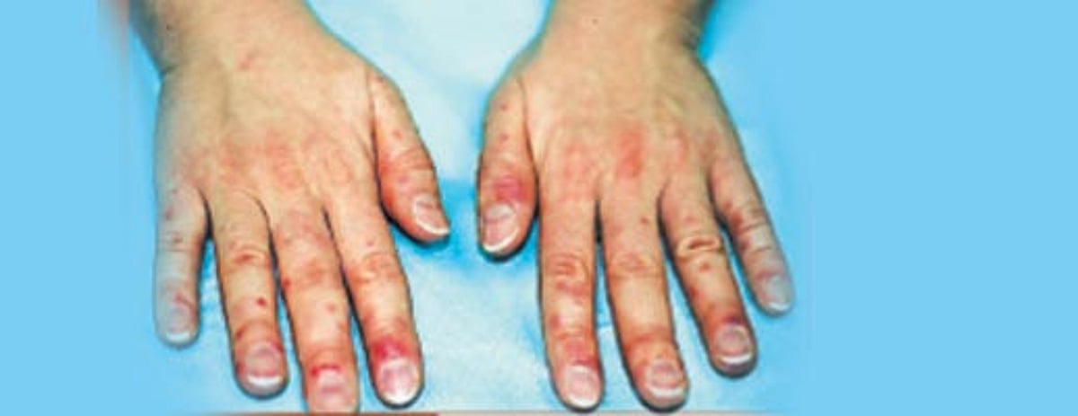 ஆயுள்காக்கும் ஆயூர்வேதம்: உடல் முழுவதும் அரிப்பு!