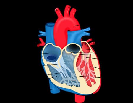 42 வயது நபரின் இதயத்தில் இருந்து மிகப்பெரிய கட்டி அகற்றம்