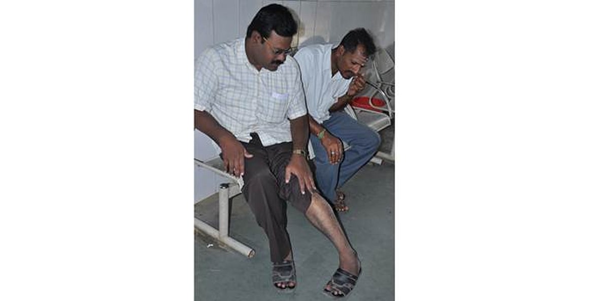 சிதம்பரத்தில் நாய்கள் அட்டகாசம்: நகரமன்ற உறுப்பினரை நாய் கடித்தது!