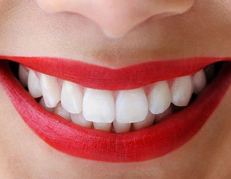 இழந்த பற்களை மீண்டும் நிலையாகப் பொருத்த...