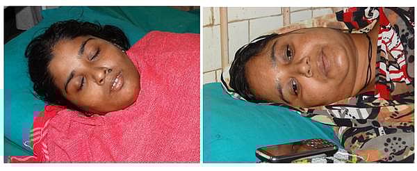 பழனி அருகே கிணற்றுக்கு வைக்கப்பட்ட வெடியில் பாறை சிதறி இருபெண்கள் காயம்