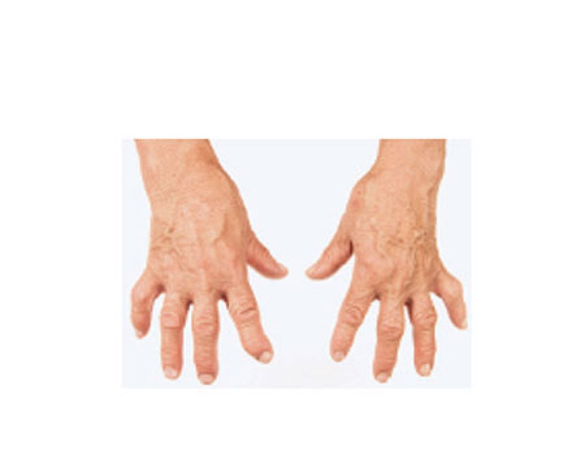 ஆயுள் காக்கும் ஆயுர்வேதம்: முற்றவிடக் கூடாது!