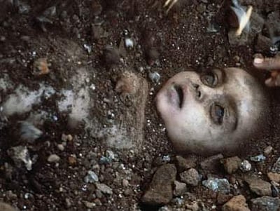 03.12.1984: உலகை உலுக்கிய போபால் விஷ வாயு கசிவு சம்பவம் நிகழ்ந்த நாள் இன்று!