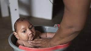 ஸிகா வைரஸ்: சர்வதேச அவசர நிலை பிரகடனம்