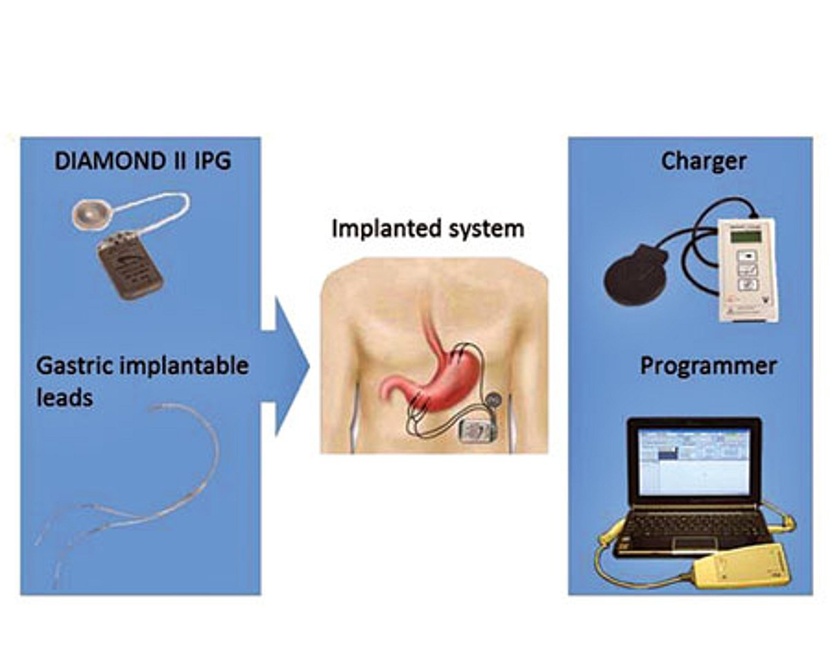 சர்க்கரை நோய்க்கு புதுக்கருவி!