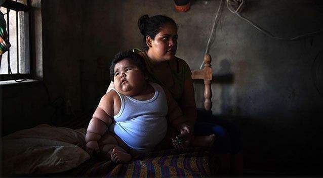 உலகின் அதிக எடையுள்ள குழந்தை லூயி மேனுவலின் தற்போதைய நிலை என்ன?