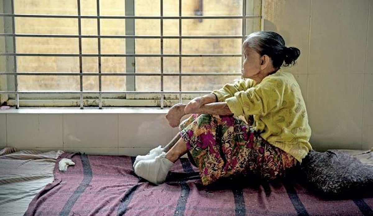 விரலும், கருவிழியும் பாதித்த தொழுநோயாளிகள் ஆதார் அட்டை பெறுவது எப்படி? பதில் சொல்லுமா மத்திய அரசு