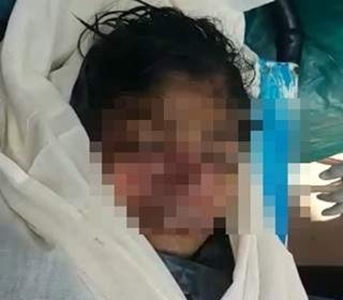 பிணவறையில் இளம்பெண்ணின் முகத்தை கடித்துக் குதறிய எலிகள்: ஹைதராபாத் பயங்கரம்!