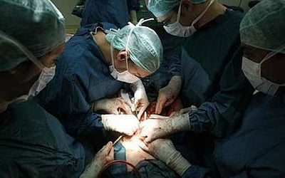 இருக்கும் இதயத்தை அகற்றாமல் இதயமாற்று அறுவை சிகிச்சை: கோவை மருத்துவர்கள் சாதனை