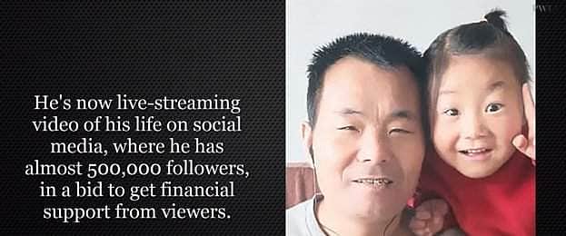 சீனாவில் தன் தந்தைக்கு அன்னையான 6 வயதுச் சிறுமியின் அயராத சேவைகள்! வைரல் வீடியோ இணைப்பு