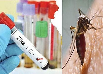 கேரளத்தில் குழந்தை உள்பட மேலும் 3 பேருக்கு ஜிகா வைரஸ்