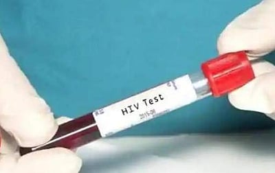 சென்னை கீழ்ப்பாக்கம் மருத்துவமனையிலும் கர்ப்பிணிப் பெண்ணுக்கும் ஹெச்ஐவி ரத்தம் செலுத்தப்பட்டதா?