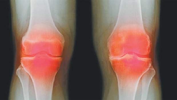 ஆயுள் காக்கும் ஆயுர்வேதம்: மூட்டுத் தேய்மானத்தைச் சரி செய்ய...!