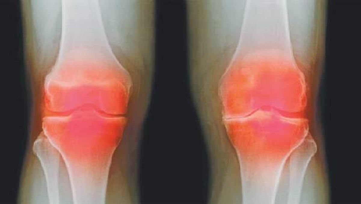 ஆயுள் காக்கும் ஆயுர்வேதம்: மூட்டுத் தேய்மானத்தைச் சரி செய்ய...!