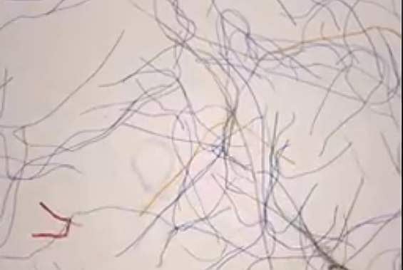 மைக்ரோ ஃபைபர் எனும் பிளாஸ்டிக் அரக்கனின் சுயரூபம்! தடை செய்வது எப்போது?