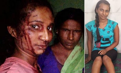 ஆட்டை மீட்பதற்காக கம்பெடுத்து புலியுடன் சண்டை போட்ட வீரப்பெண்: ரத்தம் சொட்ட ஒரு செல்ஃபி! 