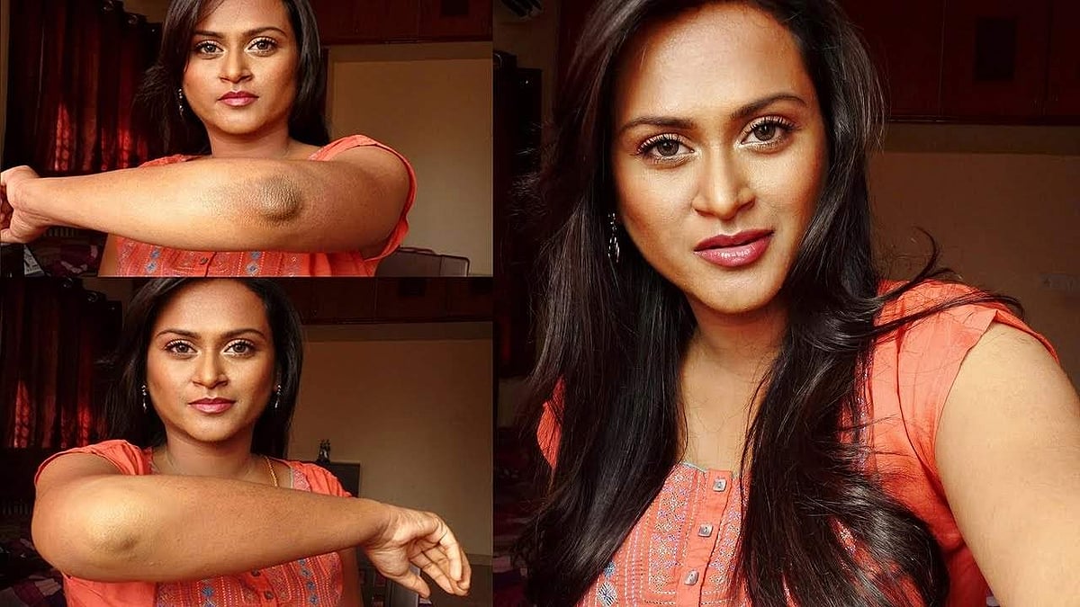 உங்கள் முழங்கையிலும், முழங்காலிலும் கருப்புத் திட்டுக்களா? இப்படி செஞ்சு பாருங்களேன்!