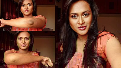 உங்கள் முழங்கையிலும், முழங்காலிலும் கருப்புத் திட்டுக்களா? இப்படி செஞ்சு பாருங்களேன்!