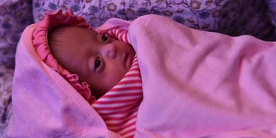 அதிசயமே அசந்து போகும் செர்ரி: தெற்காசியாவின் மிகச் சிறிய அதிசயக் குழந்தை