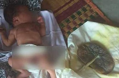 மனைவிக்கு கணவரே பிரசவம் பார்த்த மற்றுமொரு பகீர் கதை, குழந்தையின் தொப்புள் கொடியை நீக்க மறுக்கும் அதிர்ச்சி!