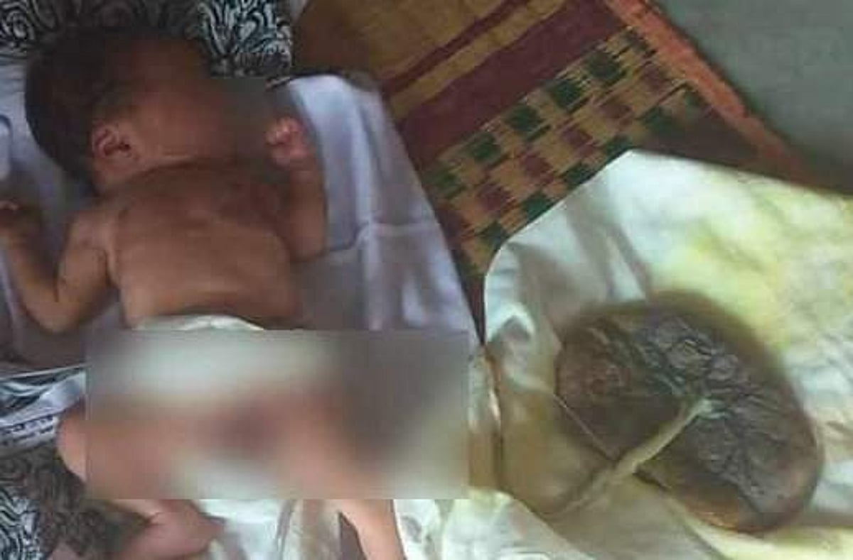 மனைவிக்கு கணவரே பிரசவம் பார்த்த மற்றுமொரு பகீர் கதை, குழந்தையின் தொப்புள் கொடியை நீக்க மறுக்கும் அதிர்ச்சி!