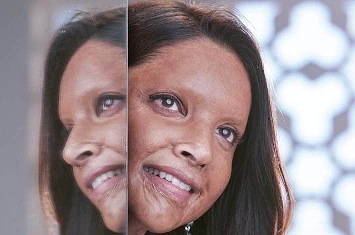 அமில வீச்சில் பாதிக்கப்பட்ட லட்சுமி அகர்வால் வேடத்தில் நடித்துள்ள தீபிகா படுகோன்: சபாக் பட டிரெய்லர் வெளியீடு!