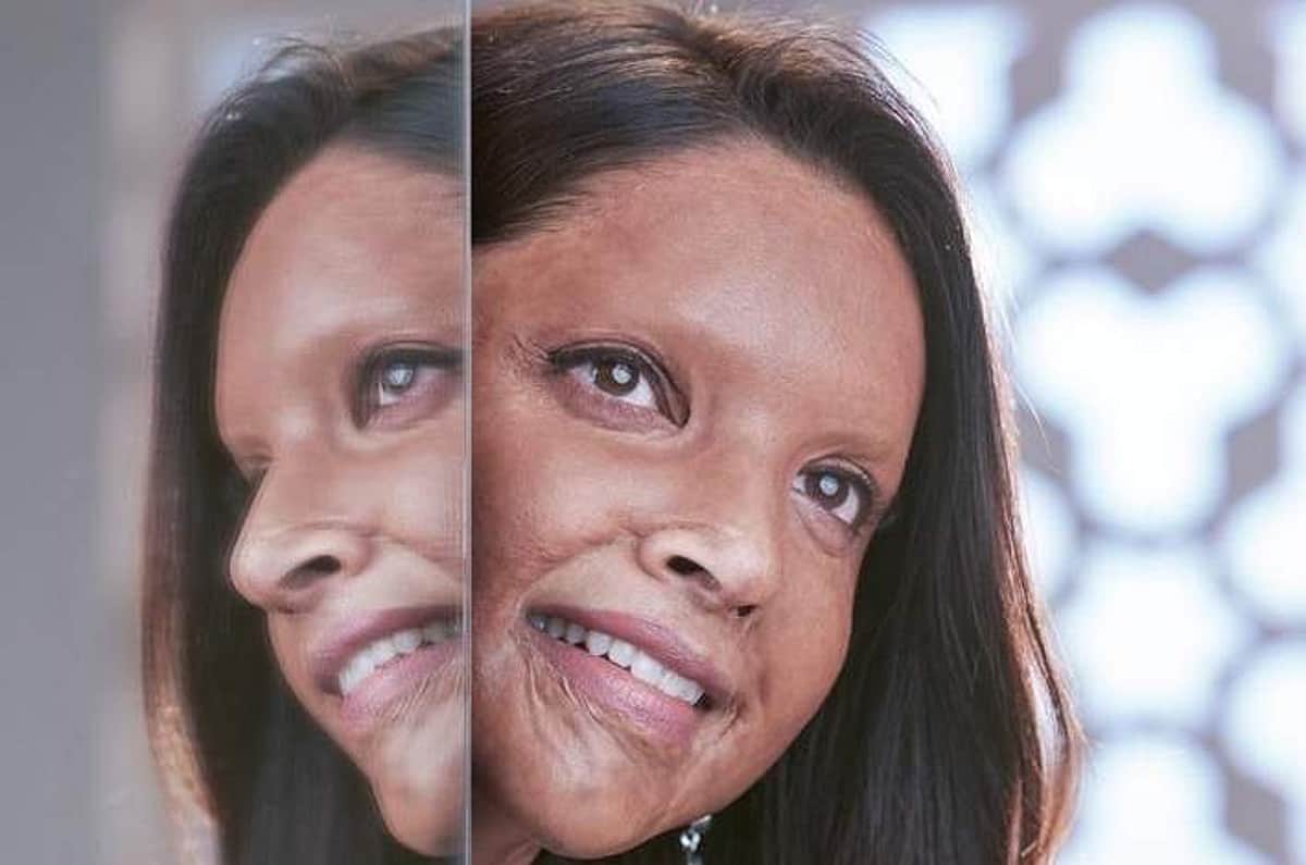 அமில வீச்சில் பாதிக்கப்பட்ட லட்சுமி அகர்வால் வேடத்தில் நடித்துள்ள தீபிகா படுகோன்: சபாக் பட டிரெய்லர் வெளியீடு!